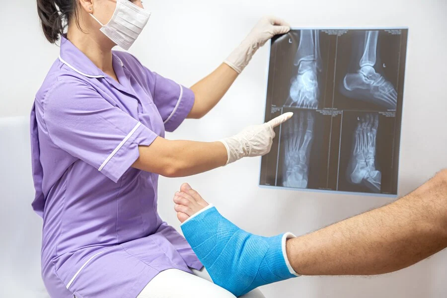 How to File a Claim For a Broken Bone After a Car Accident in NJ